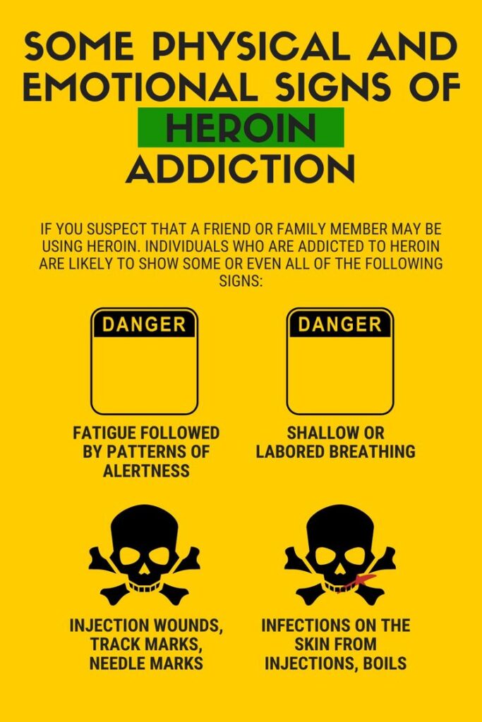 Heroin addiction is a chronic, relapsing disorder characterized by compulsive drug-seeking, continued use despite harmful consequences, and long-lasting changes in the brain.