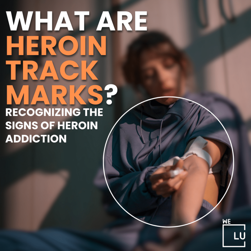 Heroin track marks, also known as needle marks or injection marks, are visible signs on the skin caused by the repeated use of intravenous (IV) drugs.