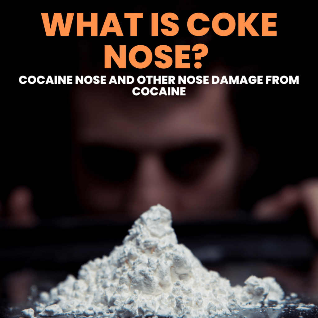 Among the many long-term effects of cocaine, Coke nose is a term colloquially used to describe the nasal damage and related issues associated with the chronic use of cocaine.